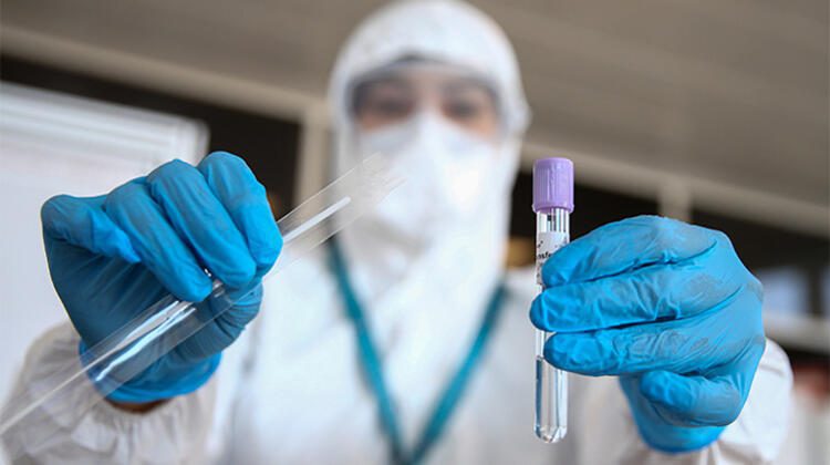 Aşı olmayan işçiye PCR testi şartı | Line Haber